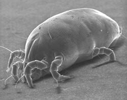 Dust Mites: A Microscopic Threat to Your Health