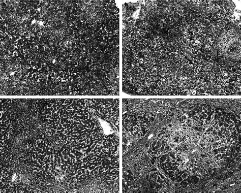 The stages of fibrosis of the representative liver samples. ( a ) The... | Download Scientific ...