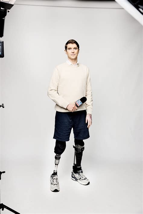 Fox News Anchor With Prosthetic Leg Shop | www.jkuat.ac.ke