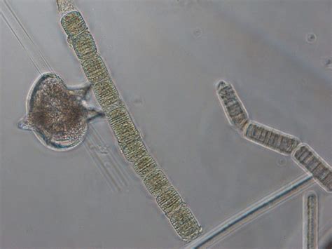 OUTPACE – Diazotrophs – MIO Plankton images