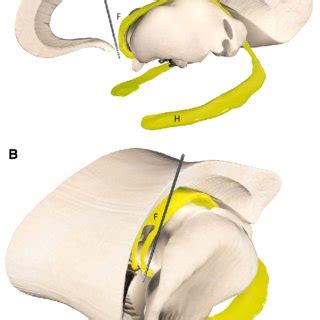 (PDF) The effect of fornix deep brain stimulation in brain diseases