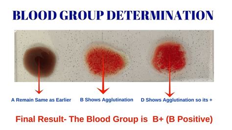 Determination of blood group practical - YouTube