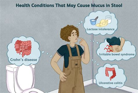 Can IBS Cause Mucus in Stool? Yes and Here's Why