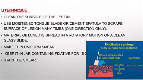 BIOPSY | PPT