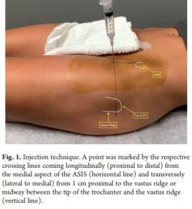 Patients with clinical radiographic intra-articular hip pathology benefit non-image-guided ...