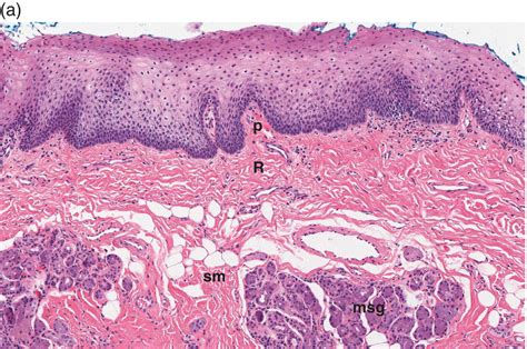 Oral Mucosal Epithelium - Busty Milf Sex