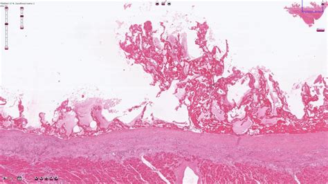 Pericardium Histology