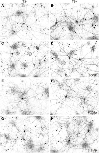 GABAergic neurons in 14-day-old neocortical networks grown with or ...