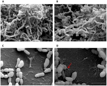 Streptococcus mutans biofilm - microbewiki