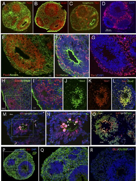 Radial glia and excitatory progenitors differentiate from hiPSCs at day... | Download Scientific ...