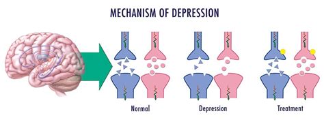 The serotonin theory of depression: is it supported by evidence? - Dr Mark Horowitz, MBBS PhD