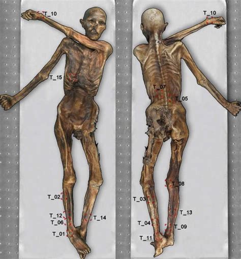 “Ötzi”: Tullac, zeshkan me prejardhje nga Anadolli – Epoka e Re