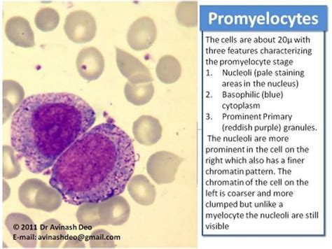 Myelocyte Vs Promyelocyte - - Yahoo Image Search Results Laboratory ...