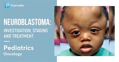 Neuroblastoma -Investigation, Staging and Treatment