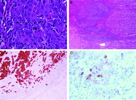 Characteristically there were observed plenty intraepithelial... | Download Scientific Diagram