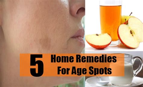 5 Age Spots Home Remedies, Natural Treatments & Cure | AyurvedicCure.com
