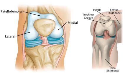 Trochlear Knee