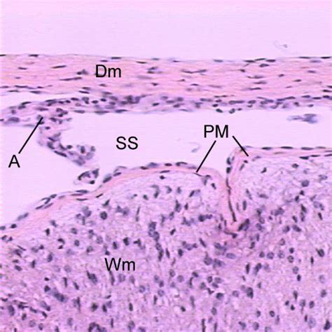 Pia Mater Histology | Bathtub Reference For You | Dura mater, Spinal ...