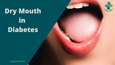 How to Manage Dry mouth in diabetes - Zorg Health