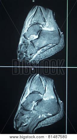 Mri Scan Test Results Image & Photo (Free Trial) | Bigstock