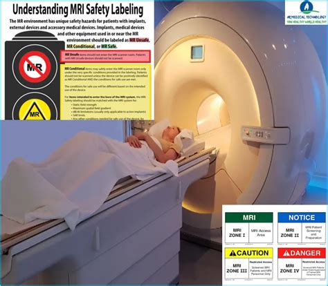 What is a MRI Safety List Best Way To Learn 24