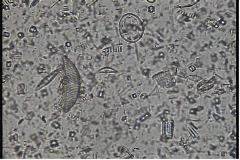 Protist 2 Lab Flashcards Quizlet