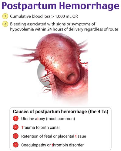 Postpartum Care Flashcards Quizlet