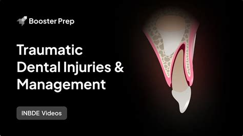 Pediatrics Traumatic Dental Injuries And Management Inbde Nbde