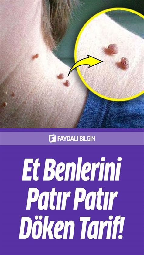 Et Benlerini Patır Patır Döken Tarif Doğal sağlık Cilt Doğal cilt