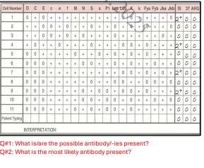 Blood Bank Special Topic Antibody Identification Flashcards Quizlet