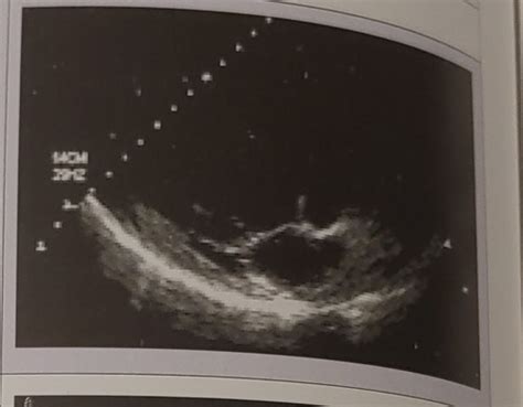 Physics Chapter 14 Pulsed Echo Instrumentation Flashcards Quizlet