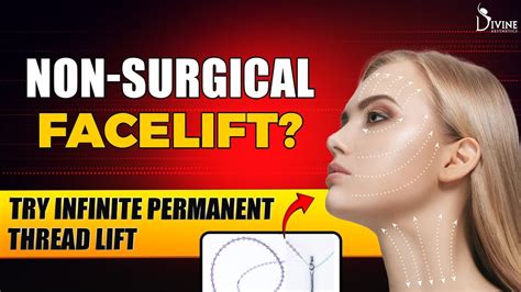 Non Surgical Facelift Try Infinite Permanent Thread Lift Dr Amit