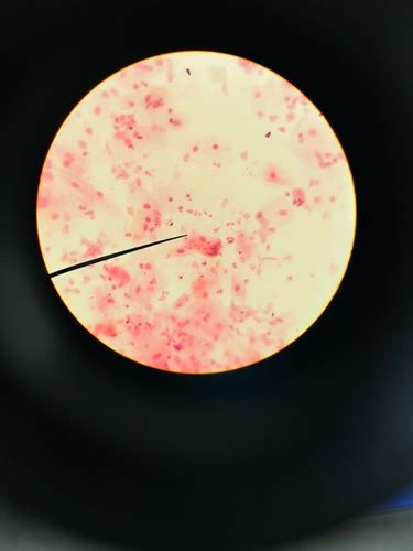 Exam Lab Microscope Pictures Flashcards Quizlet