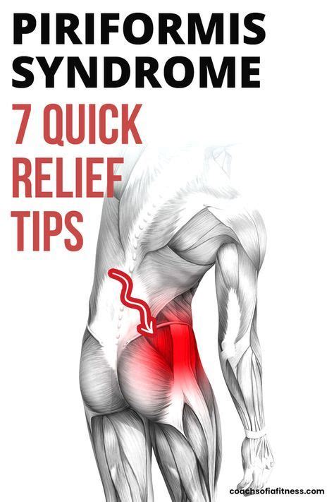 Piriformis Syndrome 7 Tips To Get FAST Relief No Exercises Or