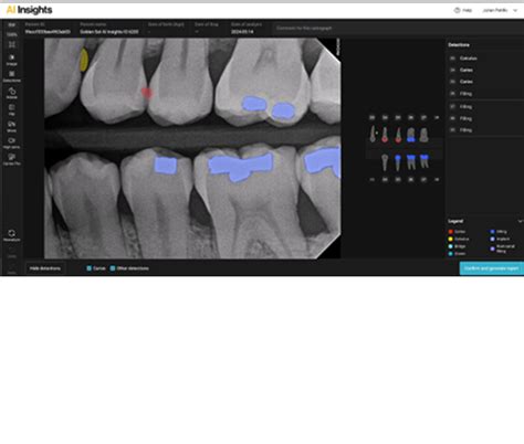 What S New In Cs Imaging V Carestream Dental