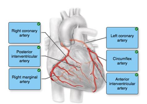 Vascular Cardiac And Interventional Radiography Flashcards Quizlet