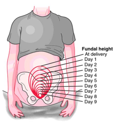 Postpartum Care Flashcards Quizlet