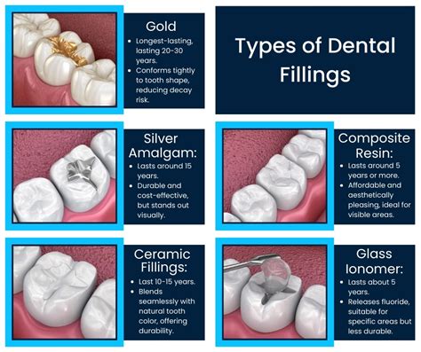 Best Composite Materials Dental Zyphoria