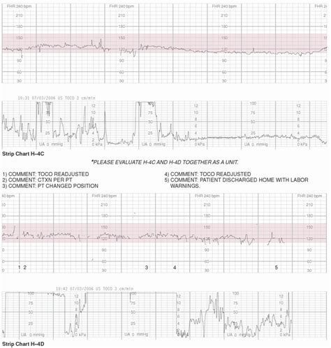 Exercises In Electronic Fetal Monitoring Obgyn Key