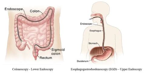 Esophagogastroduodenoscopy Anatomy