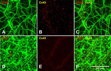 Representative Gfap And Cx Staining In Whole Mounted Retinas From An