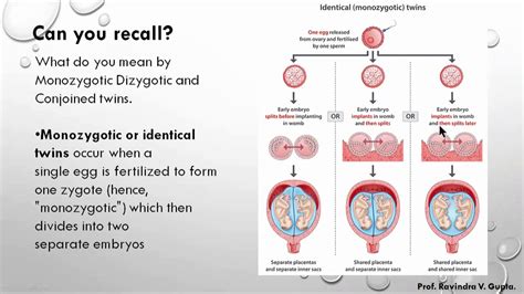 Monozygotic Twins Dizygotic Twins And Conjoined Twins Ll Human Reproductive System Ll 12 Th