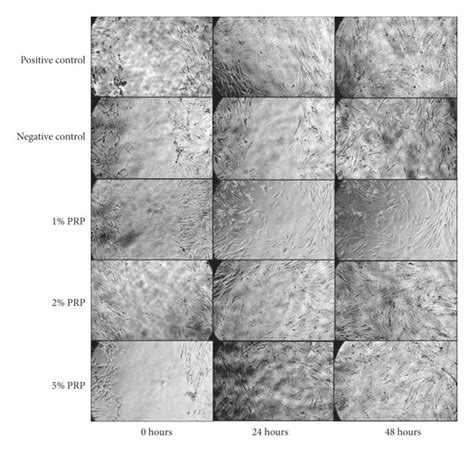 Scratch Wound Healing Assay At 0 24 And 48 H Time Points Original Download Scientific