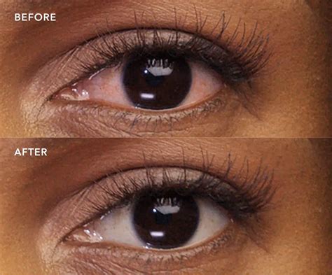 How Lumify Redness Reliever Eye Drops Work Differently