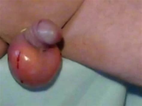 Injection Saline Gay Amateur Amateur Porn Xhamster