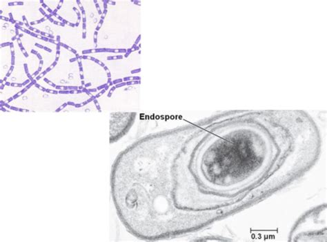 Lab10 Endospore Stain Flashcards | Quizlet