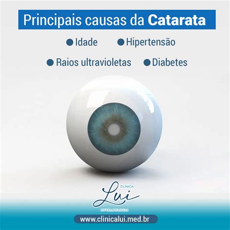 Principais Causas Da Catarata Lui Oftalmologia