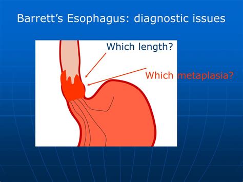 Ppt Barretts Esophagus Endoscopic Diagnosis Powerpoint Presentation