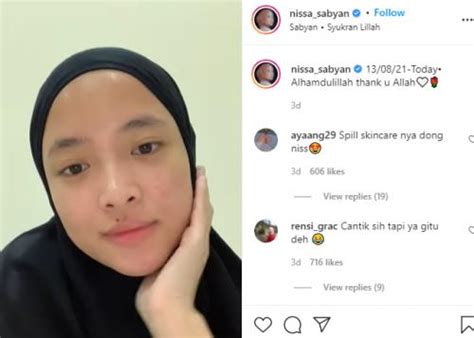 Nissa Sabyan Pamer Transformasi Wajah Super Mulus Netizen Sayang