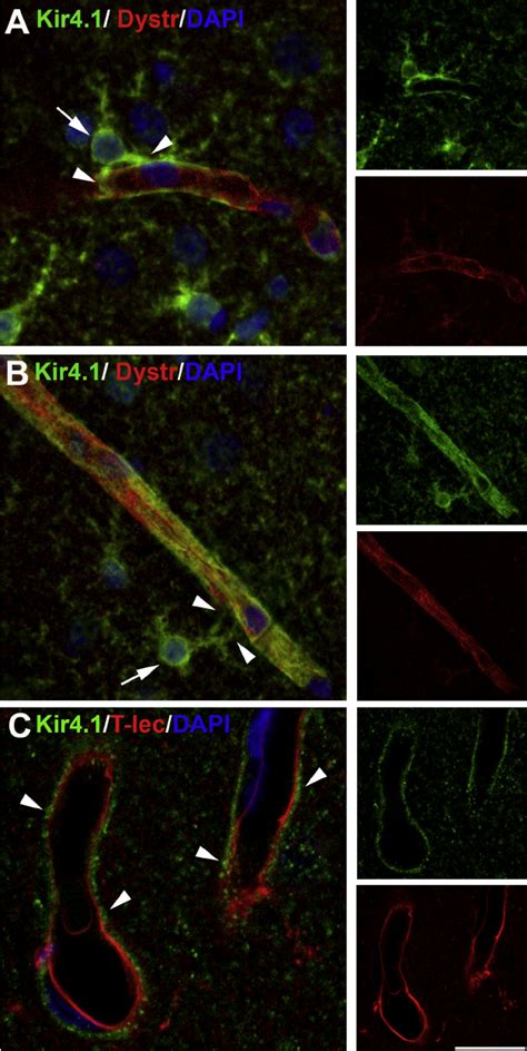 Double Immunofluorescence For Kir4 1 And Dystrophin Or Tomato Lectin